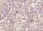 phospho-HSP70 (Tyr611) Rabbit pAb